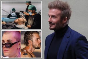 ‘Secret’ celeb-inspired procedure on the rise among men